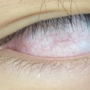 서울새봄안과의원 이미지