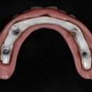 엘리트치과기공소 이미지