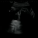 유방5통 이미지