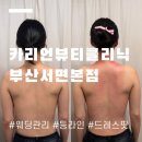 바디클리닉303 | 서면웨딩관리 등관리 프라이빗 카리언뷰티클리닉 솔직후기