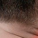 판교바른신경외과의원 이미지