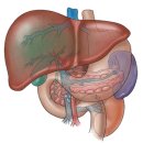 신생아 답즙정체증(Neonatal Cholestasis) 이미지