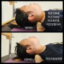 본기구필라테스 | 대전필라테스 본기구필라테스 체형교정