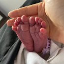 신생아 딤플 초음파 후기 (광명성애병원, 서울대어린이병원)