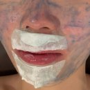 본에스테틱스킨&바디 | 시흥 에스테틱 영스킨앤바디 여드름 특수관리 후기