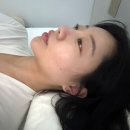 비오티스튜디오 | 논현피부관리 비오티스튜디오 파워리프팅관리 후기