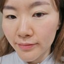 종로피부화장품 | 을지로 종로피부과 쥬베룩 손주사 피부진단기 후기