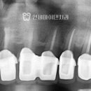 종로크라운 이미지