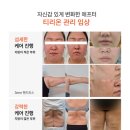 뷰티크오로라 | 인천 미추홀구 뷰티크오로라 후기｜된다리프팅 티리온 직접 받아본 솔직한 변화 (내돈내산)