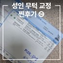 성인무턱교정 후기 ⑩ 무턱 교정 옆모습, 10개월차 후기