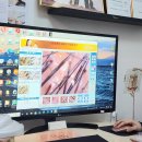 동아산소 | 대구 수성구 탈모예방클리닉 두피스케일링 더블유엠에스테틱 수성동아점