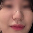 리즈온의원 | 모란 피부과 성남 리즈온의원 ୨୧ ⊹ ᜊ ˖ ꕤ ∘ ₊ 저의 최애 피부과를 소개합니다˚₊‧⁺˖✧