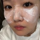 기미 주근깨 흑자제거 루비레이저 내돈내산 1회만으로 놀라운 경험한 후기 (부작용, 가격, 통증, 상담)