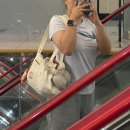 때빼멍 | 예신 다이어트 팔뚝 지방추출주사 당일부터 2주차 라인변화 / 멍 붓기 통증 후기
