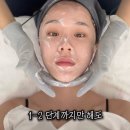 (내돈내산) 포항 피부과 안티에이징 리프팅 추천 _ 코레지 2.0