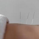 통달한의원 네이버블로그
