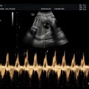 연세대학교치과대학치과병원 | 임신일기 35주 차 : 연세대학교 치과대학병원 치주과 보존과 임산부치과 블루독 신생아옷빨래