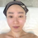 터치미인 | 청주 피부관리실 후광미인 뱀부 윤곽관리로 라인 정리하고 온 솔직 후기