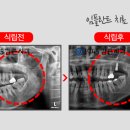 1945김근치과의원 네이버블로그