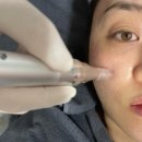 (주)정안 | 대치동 레스노베 크리스탈 (유리알 부스터), 정안침, 윤곽 페이스 종결 3종세트 후기