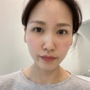 리쥬란힐러 3후기, 신논현역 피부과