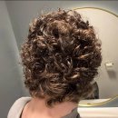 성모연합의원 | 청주 원형탈모 희망을 가져라 신약 치료 사례 편