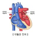 대혈관 전위(Transposition of great artery) 소아 청소년질환, 순환기 질환이란? 이미지