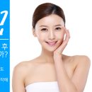 스티치킹콩 이미지