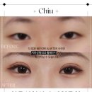 치유성형외과의원 이미지