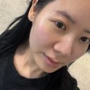 석촌역 2번출구(뒤) | 석촌역피부관리 추러스스킨케어 모공케어 프락셀효과_얼굴필링 스피큘 후기