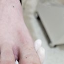 레푸스 네이버블로그