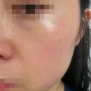 (사)참좋은친구들 | 홍조 속건조 수부지관리 내돈내산 3주사용후기 / 디마프 히어로 마이퍼스트 세럼