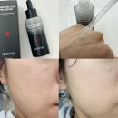 필PC | 육아맘 피부관리템 추천, 톤필링 트라넥삼산 필 세럼 후기