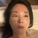 이정은 스킨앤바디