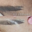 부산 눈썹문신제거 잔흔 타투 제거 리치루트더옐 무통증 솔직후기