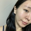 메디파워약국 | 겨울 보습템 고민될 때 약국 PDRN 크림 선택한 이유