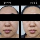 청춘당 웅천점 | 여수 피부관리 NKCL 이뮤니 에스테틱에서 윤곽관리