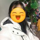M자 이마 모발이식 내돈내산 찐리얼후기(8개월 후기, 사진O)