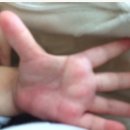 재생한의원 이미지