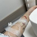 인제약국 | 인제대학교 부산백병원 갑상선암 수술 및 입원 후기...