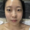 메디스킨유리하 | 여주 피부관리 체형관리 메디스킨 유리하 리프팅 관리 후기