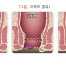 라파엘외과의원 네이버블로그