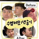 입술플러스7 | 남성 수염제모 1년치 후기/ 아포지엘리트플러스, 젠틀맥스프로 교차 시술/ 재업로드/ 내돈내산