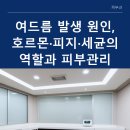 여드름 생기 원인과 호르몬·피지·세균 영향 집중 분석