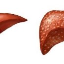 미소들노인전문병원 이미지