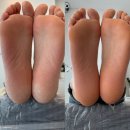 부산 연산동 발 각질관리(패디 플래닝) 전문 포이유뷰티