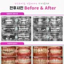 뉴욕치과기공소 이미지