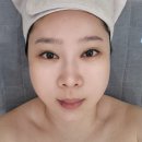 석전동400 | 마산피부관리 석전동 헤이미 리프팅, 모공관리