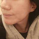 26470-01-21-406 | 강남 에스테틱 공간 추천 가성비 피부관리 후기