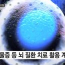 뇌에 LED 심어 감정 조절…우울증 등 치료 기대 -자살유도??? 이미지